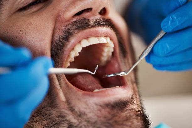 Best Emergency Treatment for Dental Infections or Abscesses in Tawas City, MI