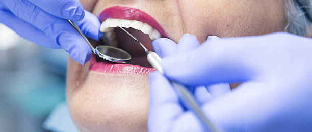 Best Emergency Dental Care for Broken or Chipped Teeth in Tawas City, MI
