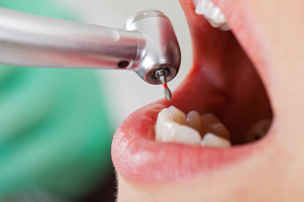 Best Pediatric Emergency Dentist in Tawas City, MI